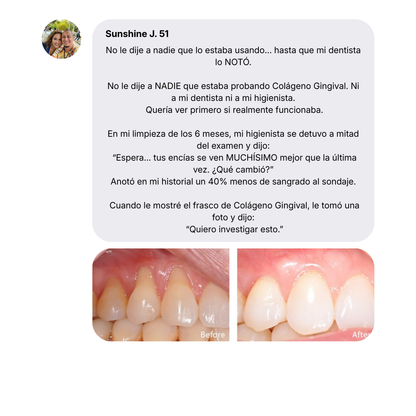 Colágeno Avanzado para Encías